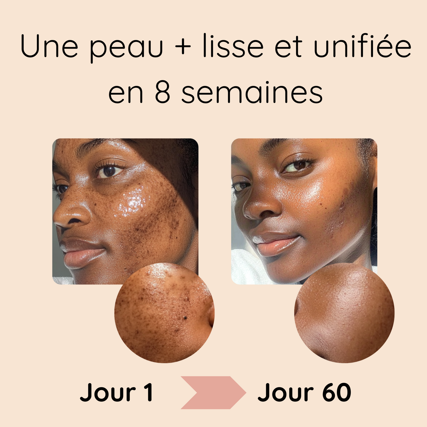 Cotons au Curcuma Anti-Imperfections